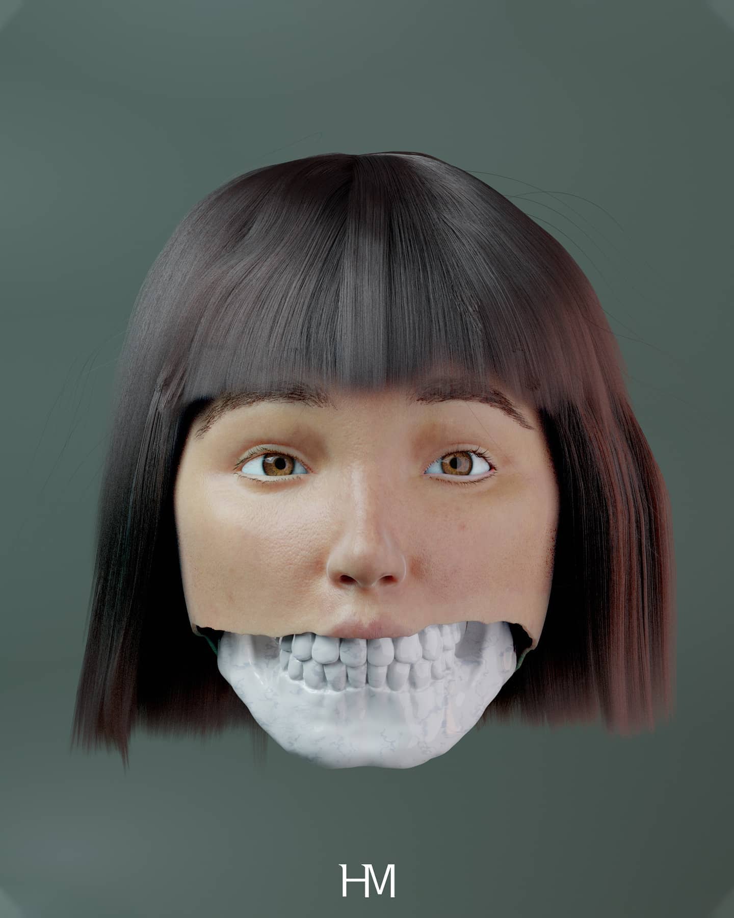 Anatomical Bone Reveal with exposed porcelain teeth and jawbone